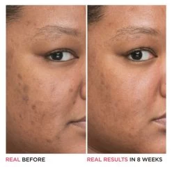 IT Cosmetics Bye Bye Dark Spots Niacinamide Serum -Verzorgingsproducten Winkel 1072751 6