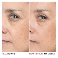 IT Cosmetics Bye Bye Lines Hyaluronic Acid Serum 11 IT Cosmetics Bye Bye Lines Hyaluronic Acid Serum -Verzorgingsproducten Winkel 1072752 5