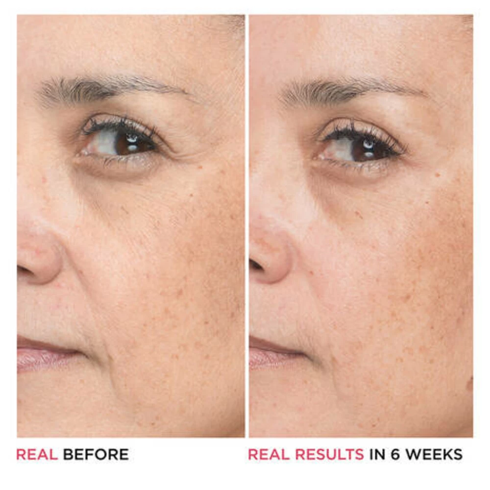 IT Cosmetics Bye Bye Lines Hyaluronic Acid Serum 7 IT Cosmetics Bye Bye Lines Hyaluronic Acid Serum - Afbeelding 5