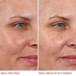 IT Cosmetics Hello Results BabySmooth Glycolic Peel + Carin Oil -Verzorgingsproducten Winkel 1072769 4