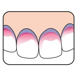 5x TePe PlaqSearch -Verzorgingsproducten Winkel 945172 4