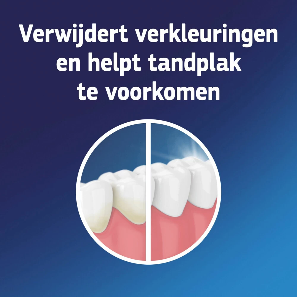 3x Fixodent Reinigingstabletten Complete Care 5 3x Fixodent Reinigingstabletten Complete Care - Afbeelding 3